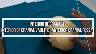 Interior of Cranial vault  &   Anterior Cranial Fossa