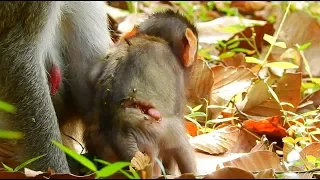 So pity small baby Janet has big wound on back look like hurt much| Jane very care her baby.