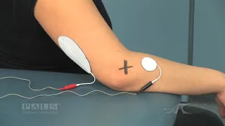 Electrode Placement for Supination (Option 1)