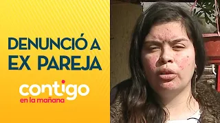 VOLVIÓ A OCURRIR: Joven denunció nuevas amenazas de su ex pareja - Contigo en La Mañana