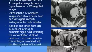 CT and MRI of female pelvis   Dr Soha Talaat In Arabic