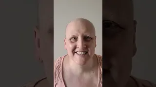 tracking hairgrowth post chemotherapy Breast Cancer Hair update after one month of finishing chemo