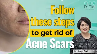 ACNE SCARS | DR RASYA DIXIT | SKIN CARE TIPS |