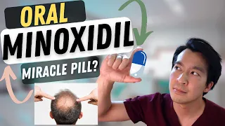 The TRUTH about ORAL MINOXIDIL from a Dermatologist!