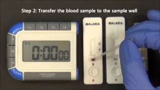 CareStart™ Malaria HRP2.Pf video instruction (Access Bio, Inc.)