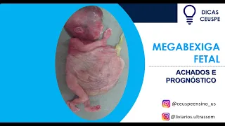 Megabexiga fetal: achados ultrassonográficos e prognóstico