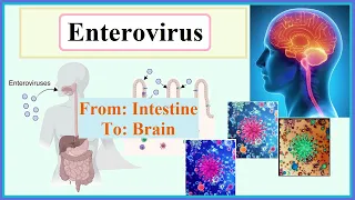 enterovirus