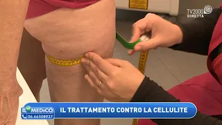 Cellulite: cosa fare? Il trattamento contro la cellulite. I cosmetici da usare