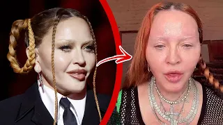 Top 10 Celebrity Surgeries That Went Horribly Wrong