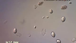 Time lapse of grape downy mildew pathogen (Plasmopara viticola)