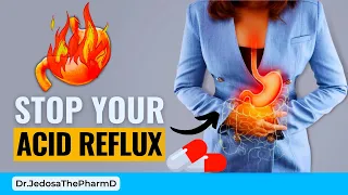 Top 6 Vitamins to Stop ACID REFLUX