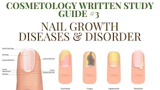 Cosmetology Written Study Guide| Nail Diseases & Disorders