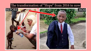 Transformation of Hope "the boy accused of witchcraft at age 2"