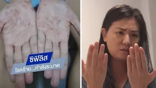 ซิฟิลิส โรคร้าย...กำลังระบาด | พบหมอมหิดล [by Mahidol Channel]