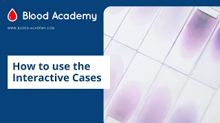 How to use the Interactive Cases