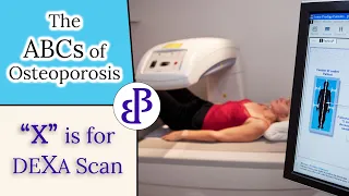 X is for Dexa Scans - The ABCs of Osteoporosis