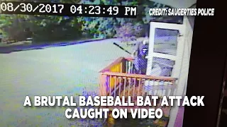 Saugerties Baseball Bat Attack