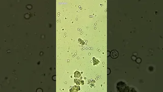 Moldy Cheeses Under Microscope (Stinky Blue Cheese)