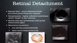 Ocular ultrasound