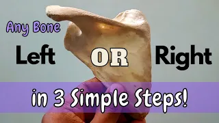 Side determination of a bone | 3 Simple steps