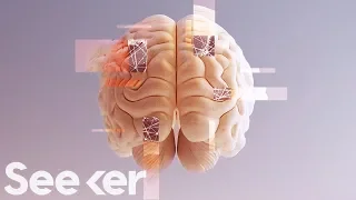 How Close Are We to a Complete Map of the Human Brain?