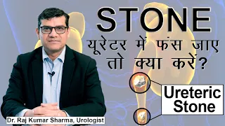 Ureter मैं फंसी  हुई पथरी/ Kidney Stone  in Ureter - Symptoms and Treatment || Dr. Raj Kumar Sharma