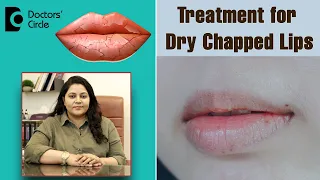 Heal Chapped Lips Fast with these 4 Simple Remedies  - Dr. Tina Ramachander | Doctors' Circle