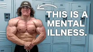 Stop glorifying steroid abuse (Sam Sulek is mentally ill)