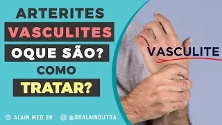 Arterites, vasculites e Doença de Takayasu - Tratamento funcional