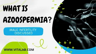 What is azoospermia? Male Infertility discussed!