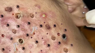 Make Your Day Satisfying with An Popping New Videos #31