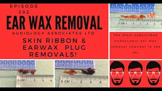 SKIN RIBBON & EAR WAX PLUG REMOVAL - EP392