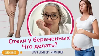 Что делать с отеками при беременности? / Виктория Матвиенко