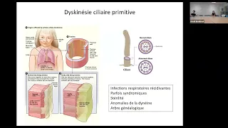 Phase socle 2022-2023 : déficit immunitaire primitif - David Boutboul