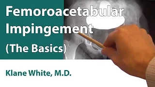 Femoroacetabular Impingement (The Basics)