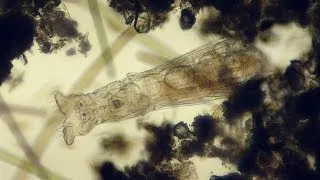 living under a microscope #1 - smooth microorganisms life in a drop of water & ralaxing sound HD
