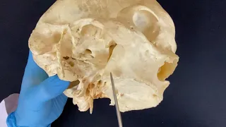 Крыловидно-небная ямка - Fossa pterygopalatina (анатомия человека)