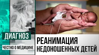 Родиться весом 640 граммов и выжить: как выхаживают недоношенных детей в Казахстане | Диагноз