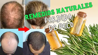 Remedios naturales y caseros para la perdida de pelo🌿