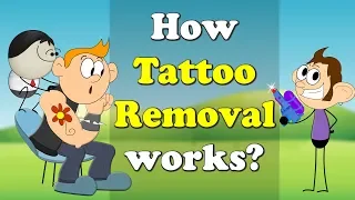How Tattoo Removal works? + more videos | #aumsum #kids #science #education #children