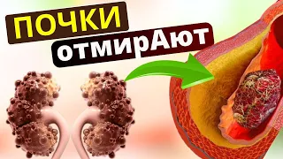 СКРЫТЫЕ и НЕ Очевидные ПРИЗНАКИ, что ПОЧКИ Отмирают, как распознать заболевания почек