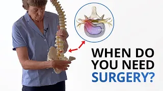 Disc Herniation: When Do You Need Surgery? (PLUS Fixing the Root Cause)