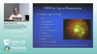 Pediatric Uveitis