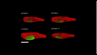Tracking cancer with a fluorescent 3-D imaging technique