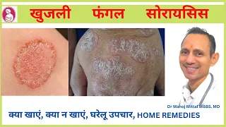 खुजली ,फंगल ,सोरायसिस क्या खाएं ,क्या न खाएं ,घरेलू उपचार , HOME REMEDIES