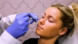 VI Peel & Botox - Same Day Treatment