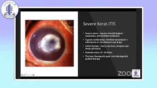 Dr. Somasheila Murthy - KERATITIS What everyone ought to know?