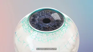 Animation of the OMNI Surgical System from Sight Sciences