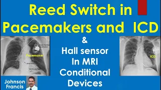 Reed Switch in Pacemakers and  ICD & Hall Sensor in MRI Conditional Devices