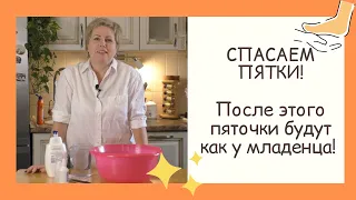 ПЯТОЧКИ БУДУТ ИДЕАЛЬНЫМИ! ГЛАДКИЕ И ЧИСТЕНЬКИЕ!